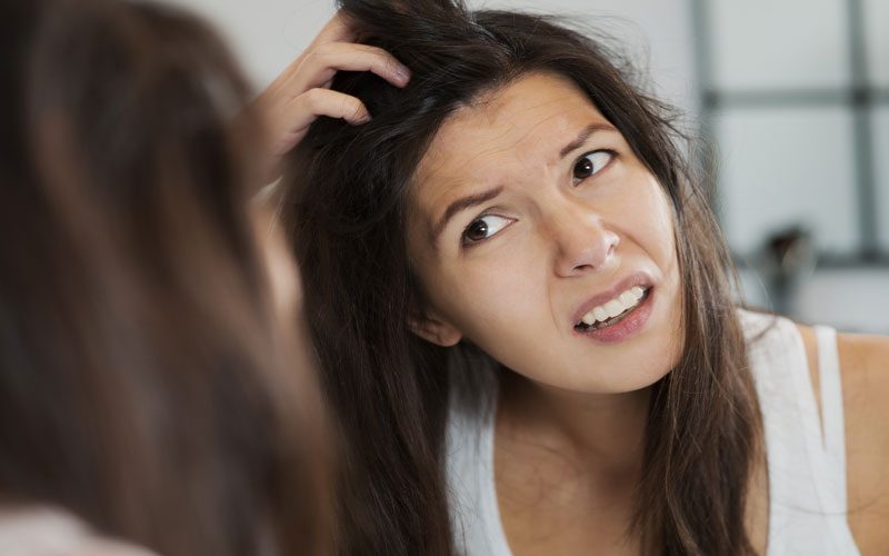 Solutions For Dandruff Problems